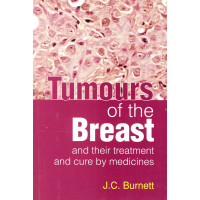 Tumors of the breast and their treatment and cure by medicines