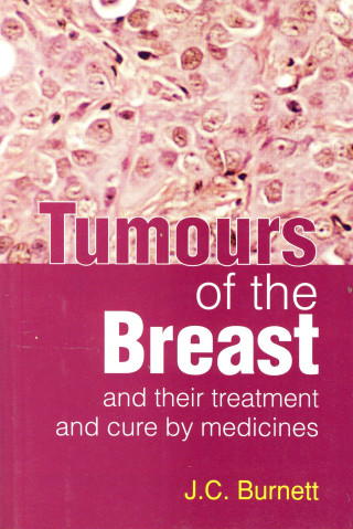 Tumors of the breast and their treatment and cure by medicines
