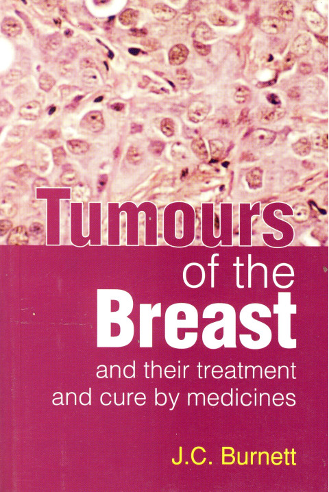 Tumors of the breast and their treatment and cure by medicines